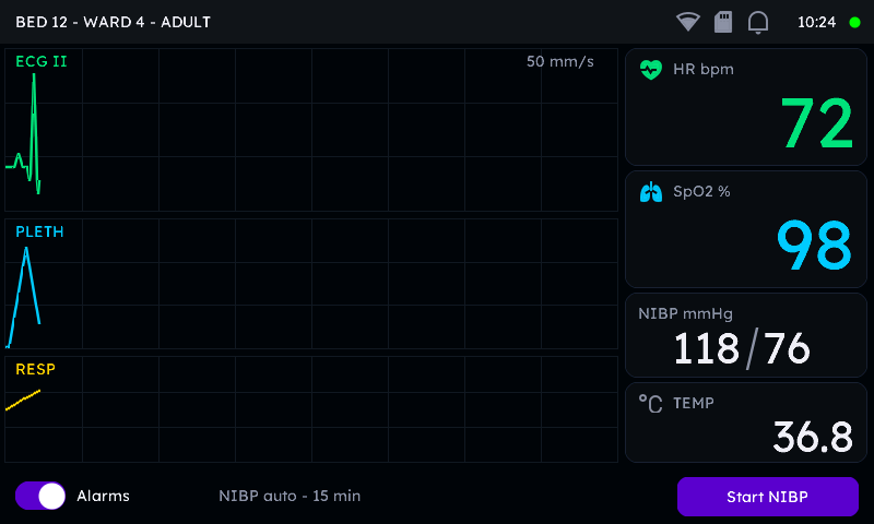 Central patient monitor rendered by the μGui C library on an 800 by 480 panel: three sweeping waveform lanes for ECG, plethysmograph and respiration, large heart-rate and SpO2 numerals, NIBP and temperature tiles, status icons, alarms toggle and Start-NIBP button