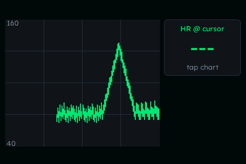 Patient HR Trend (live feed + cursor)