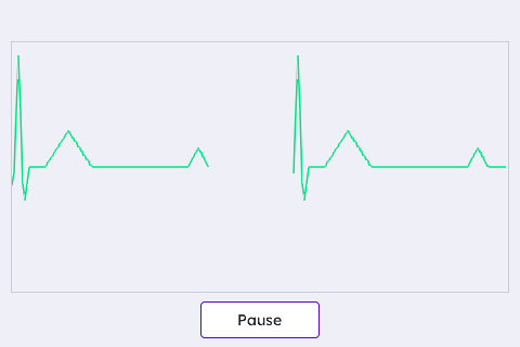 Default: Low-RAM Live ECG (Sweep)