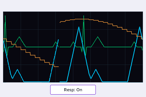 Three Channels, One Plot