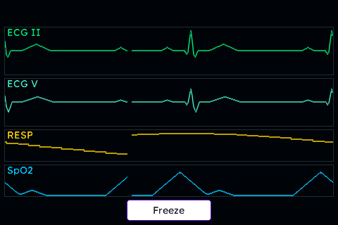 Four-Lane Patient Monitor